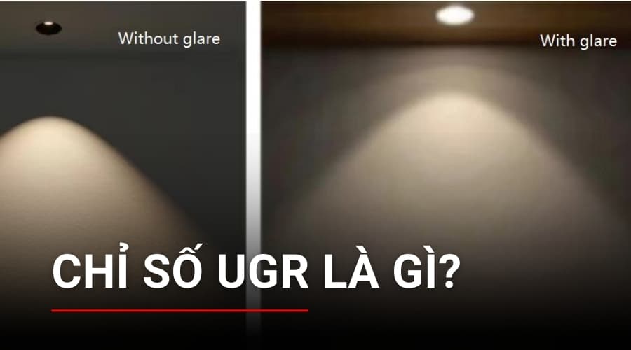 Chỉ số UGR là gì